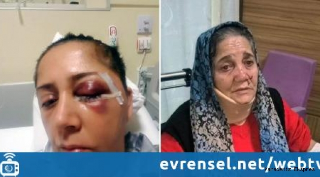 Kadın mühendis ve ailesi eski müdürü tarafından darpedildi iddiası