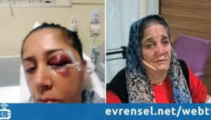 Kadın mühendis ve ailesi eski müdürü tarafından darpedildi iddiası