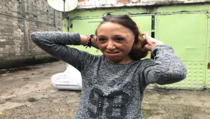 Tek dilekleri kızlarının sağlığına kavuşması