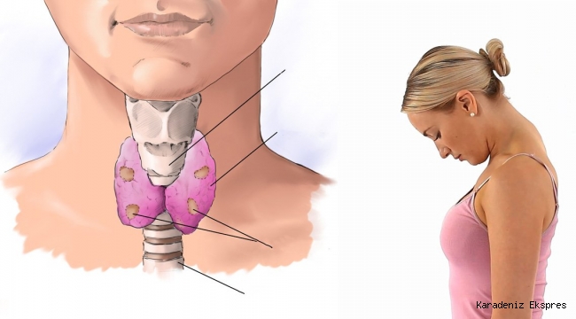 TİROİDİ ETKİLEYEN FAKTÖRLER