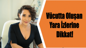  Vücutta Oluşan Yara İzlerine Dikkat!