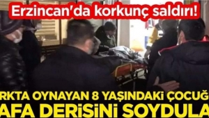 Erzincan'a sokak köpeklerinden korkunç saldırı!