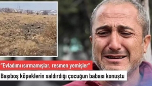 Başıboş köpeklerin saldırdığı çocuğun babası konuştu: Evladımı ısırmamışlar, resmen yemişler 