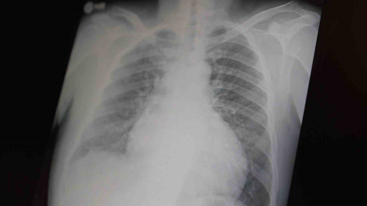 Profesör açıkladı: "Metamfetamin ve kokain gençler arasında tehlikeli boyutlara ulaştı"