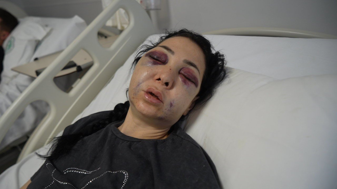 Anne ve oğlunun darp edilmesine ilişkin gözaltına alınan 3 şüpheliden 1’i tutuklandı