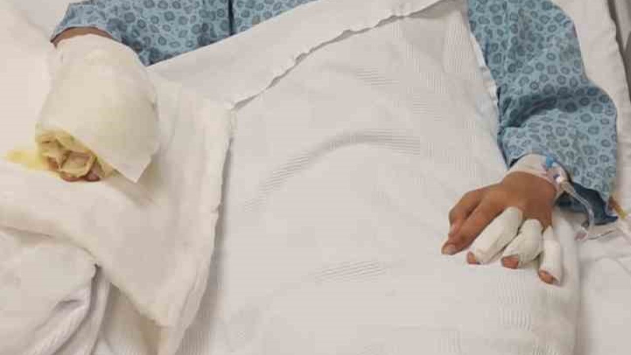 Ateşe benzin döktü, facianın eşiğinden döndü